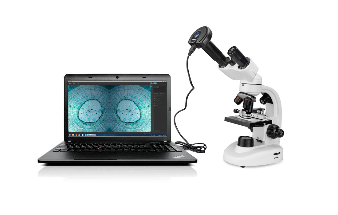 Microscope camera