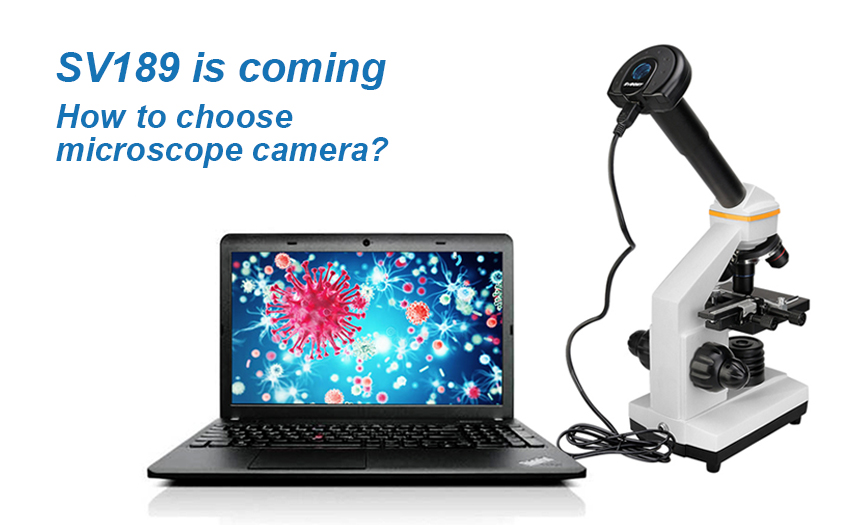 How to choose microscope camera?